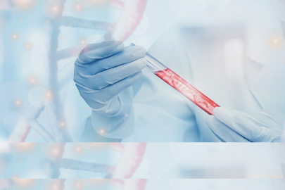 KANSERDEN KORUNMANIN 10 ÖNEMLİ KURALI!