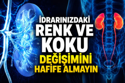 İDRARINIZDAKİ RENK VE KOKU DEĞİŞİMİNİ HAFİFE ALMAYIN