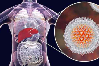 Uzmanlardan hepatit uyarısı... Sessiz ilerleyebiliyor, erken tanı hayat kurtarıyor