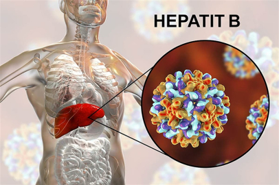 SESSİZ TEHLİKE HEPATİTİ ÖNLEMEK MÜMKÜN